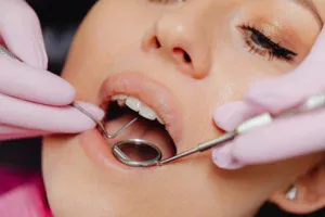 How Long Does It Really Take for a Tooth Extraction to Heal