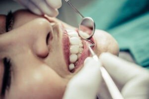 How Much Does a Filling Cost at a Private Dentist in the UK