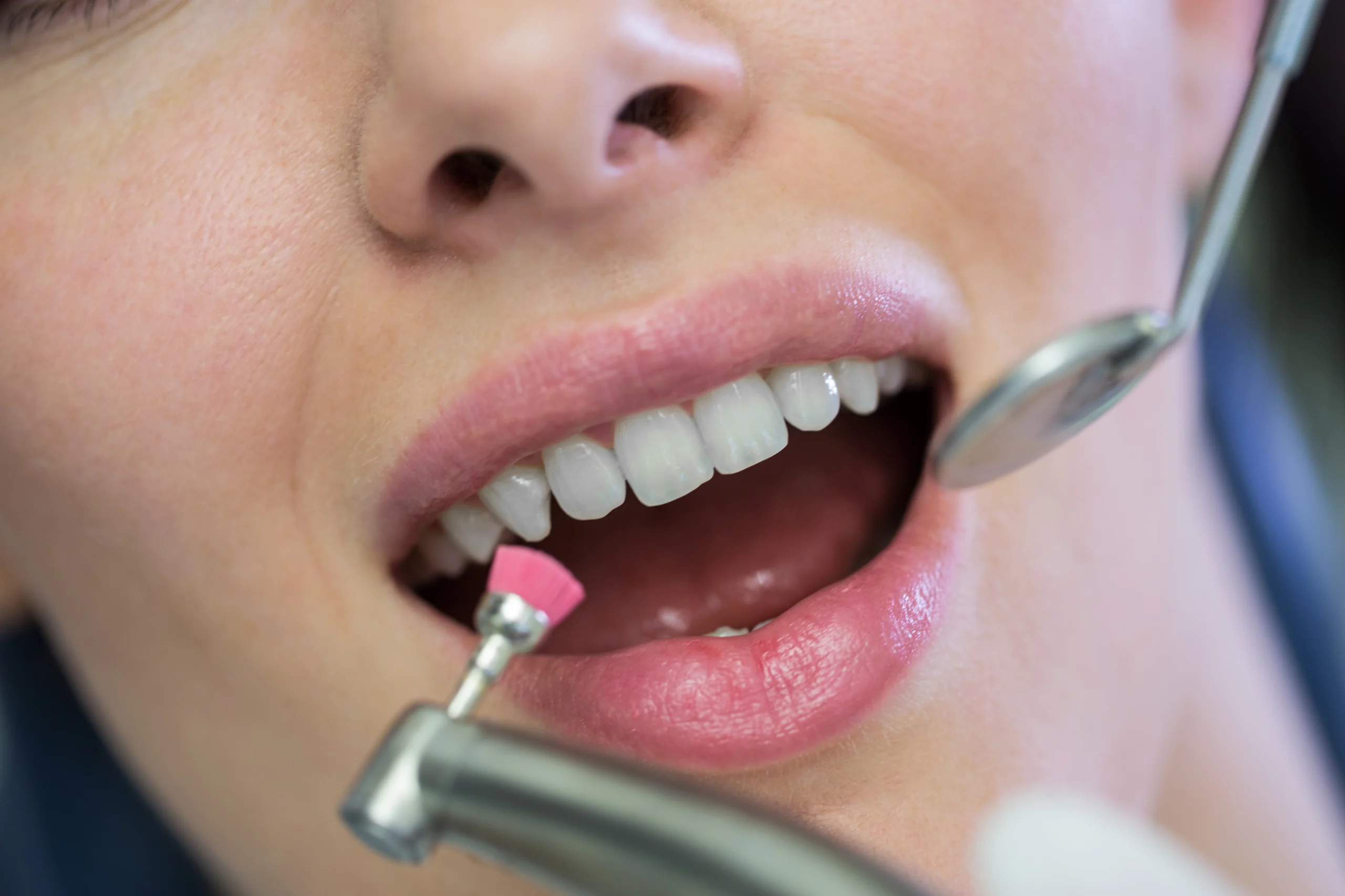 Receding Gums? Don't Panic! Here's What You Can Do