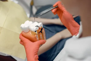 avoid a root canal